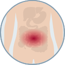 small scale illustration of pain in the abdomen