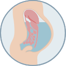 small scale illustration of fluid filling the abdomen